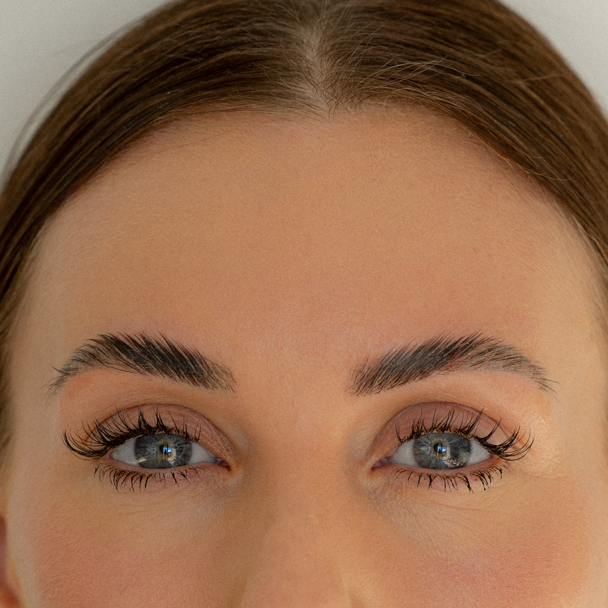 moxi treatment near me philadelphia